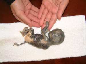 Baby aborted during second trimester.